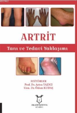 Artrit Tanı ve Tedavi Yaklaşımı