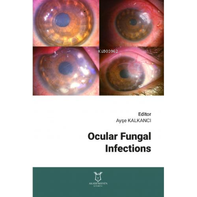 Ocular Fungal Infections